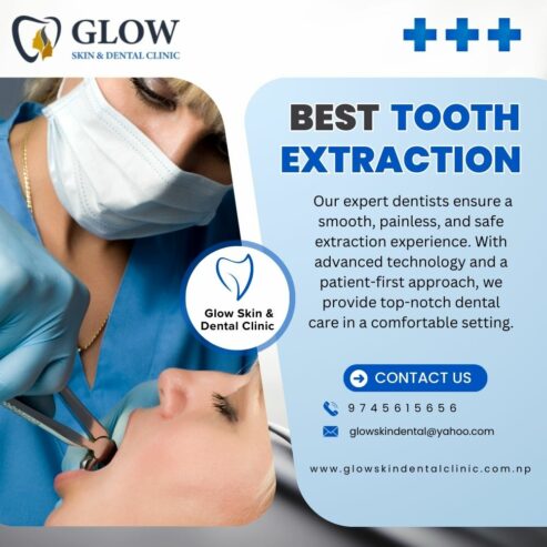 Best Tooth Extraction
