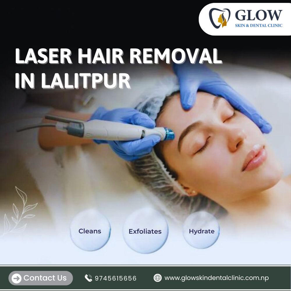 Laser Hair Removal in Lalitpur
