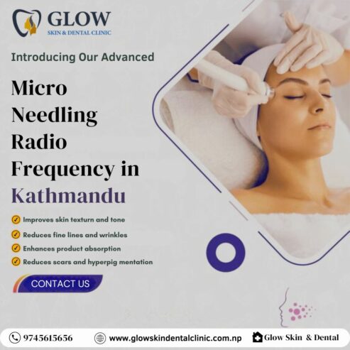 Micro Needling Radio Frequency in Kathmandu