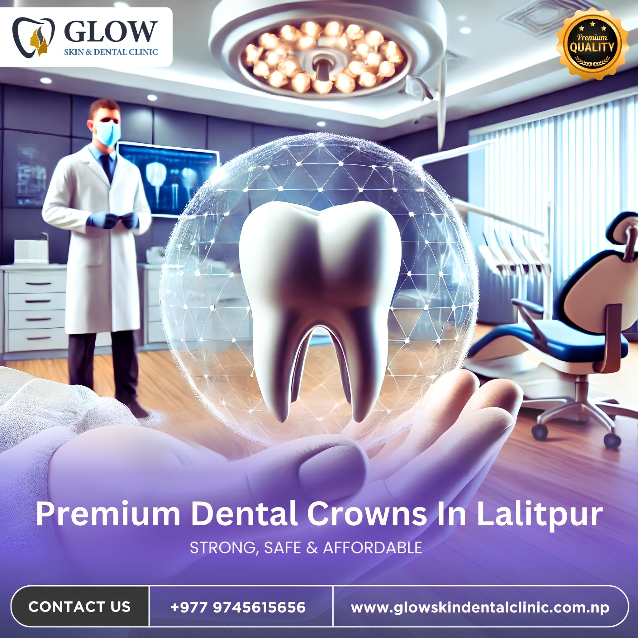 Premium Dental Crowns in Lalitpur