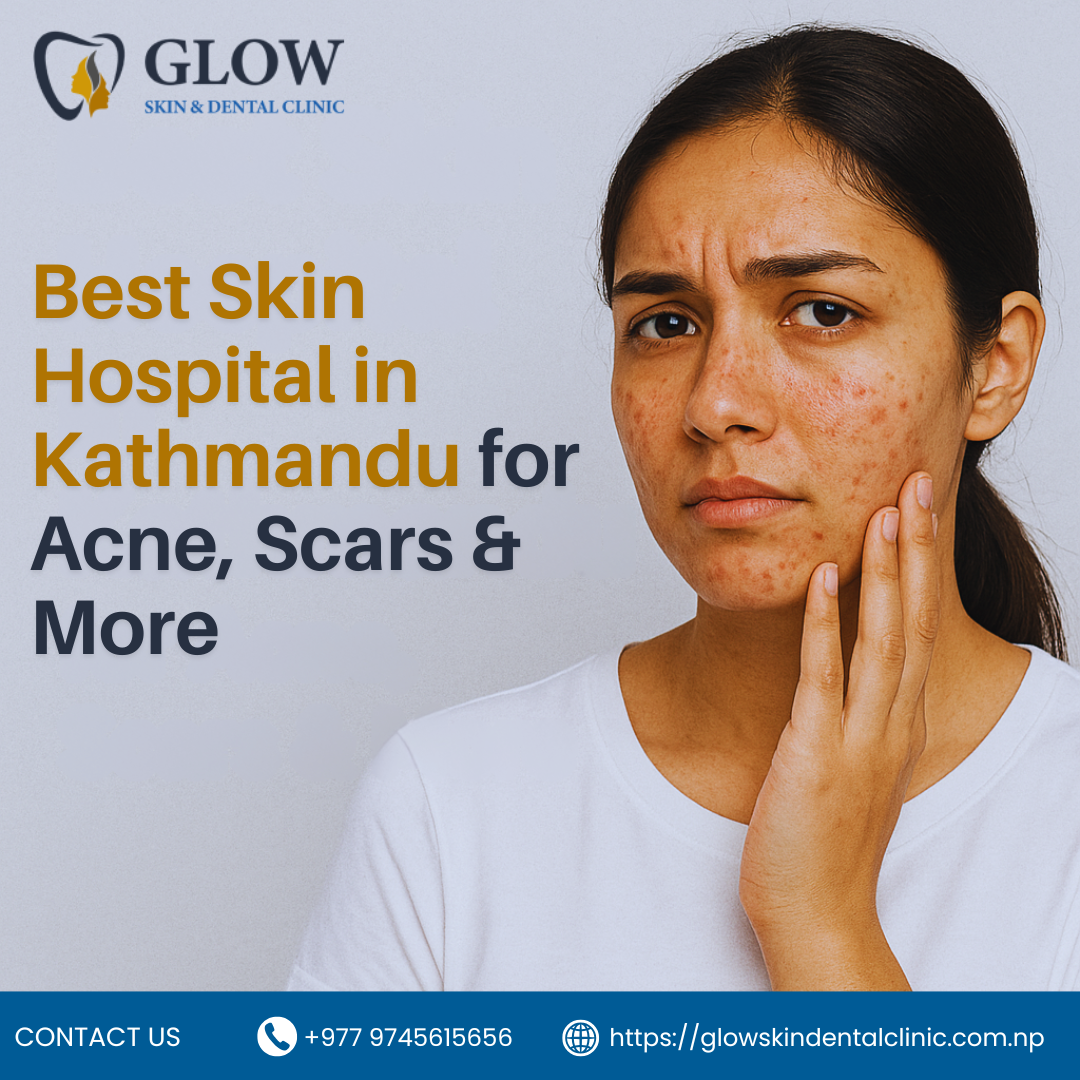 Best Skin Hospital in Kathmandu for Acne, Scars & More