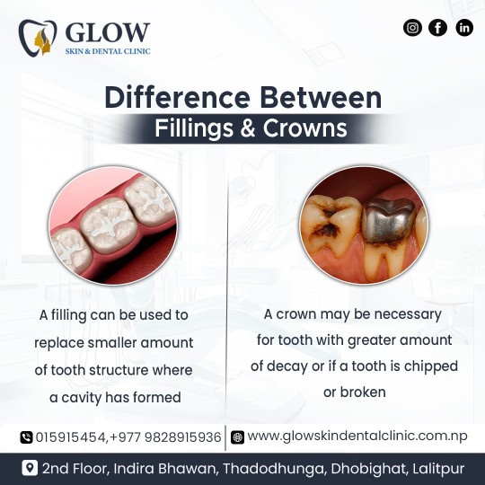 Perfect-Smile-with-the-Best-Dental-Crowns-in-Lalitpur