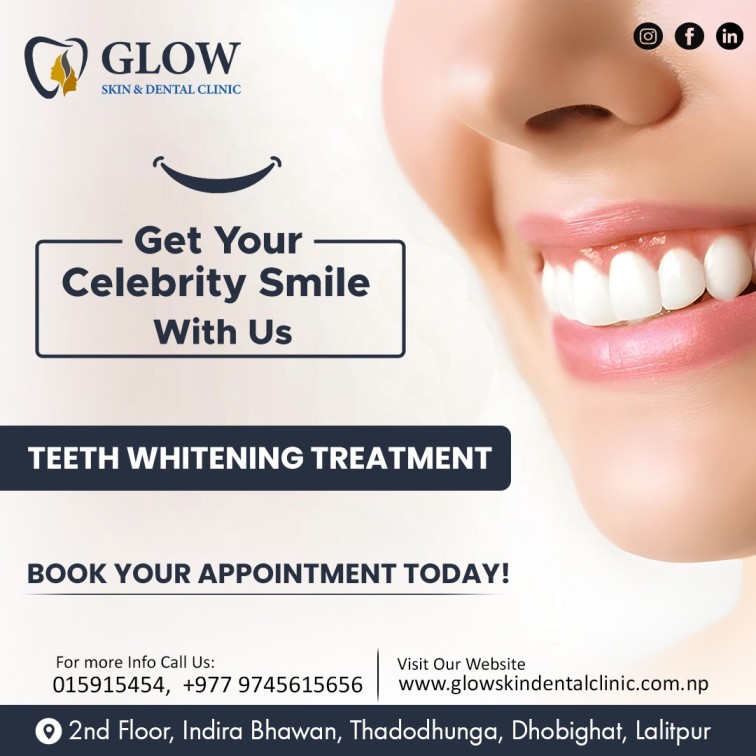 Teeth-Whitening-in-Kathmandu-–-Glow-Your-Smile.-1